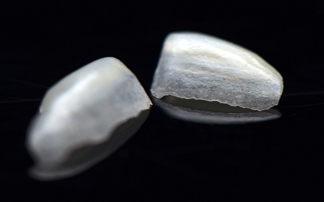 Gold stone transparent orthosis